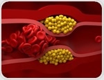 How lipoproteins shape your metabolic health